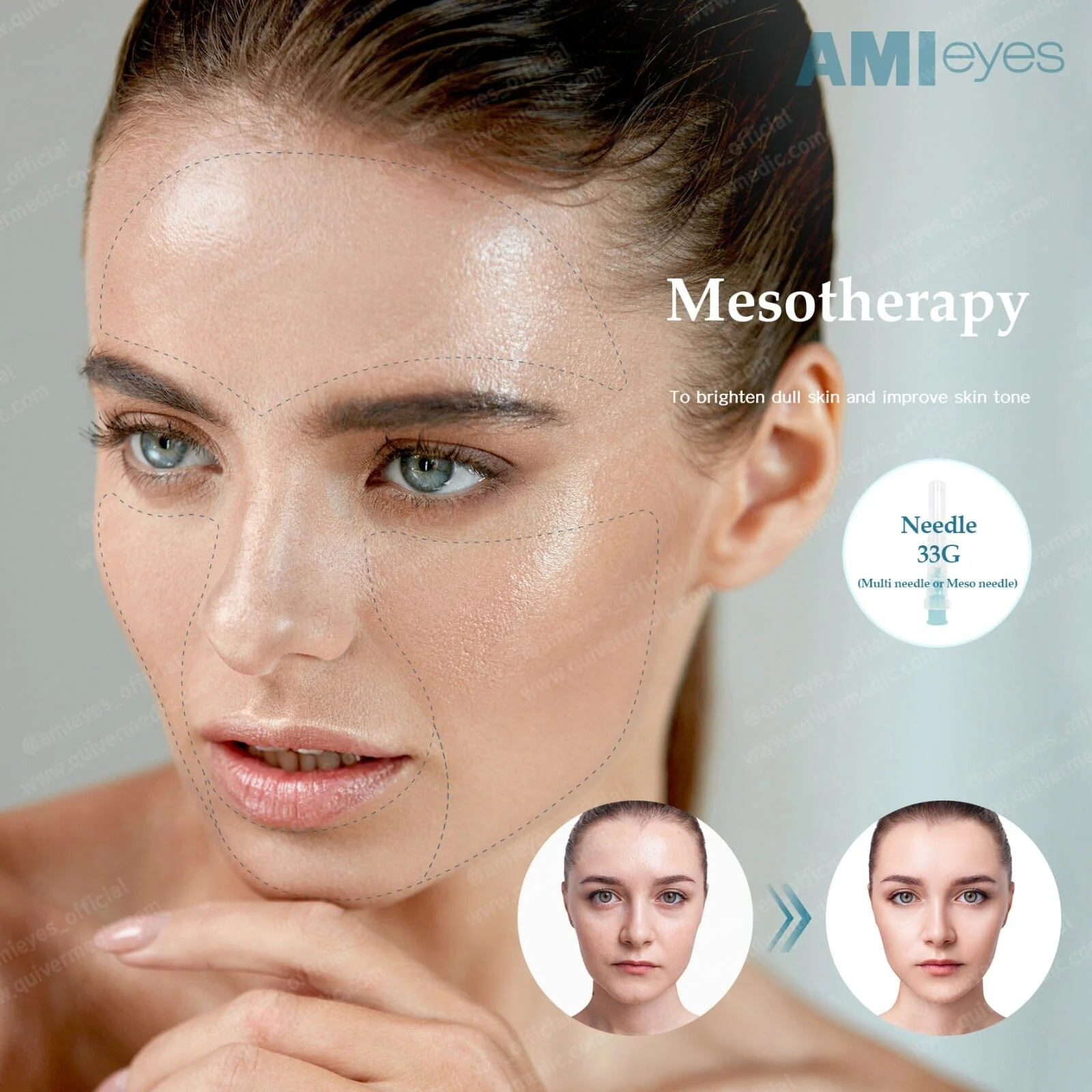 AMI EYES - Image 4