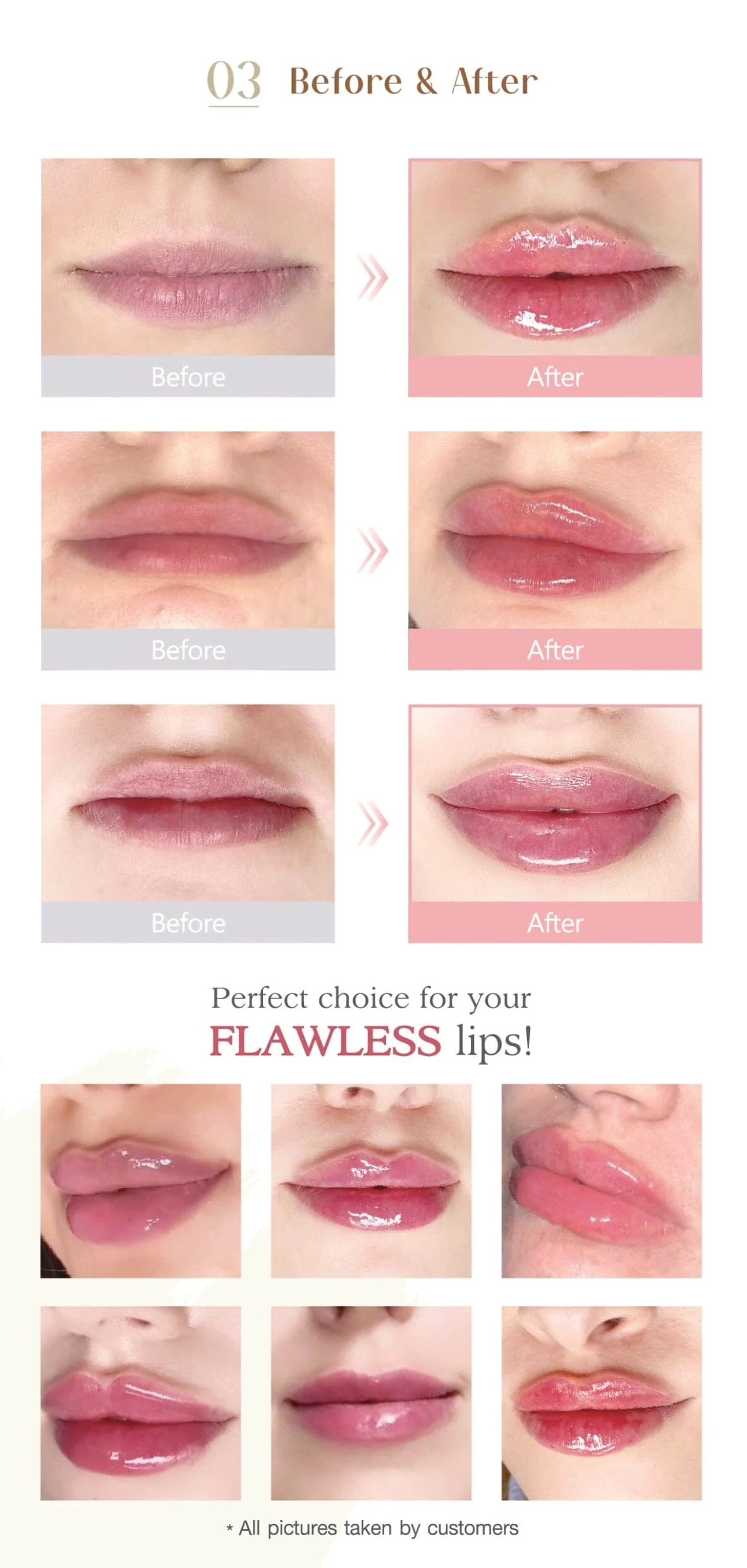 FLAWLESS SUB-Q - Image 6