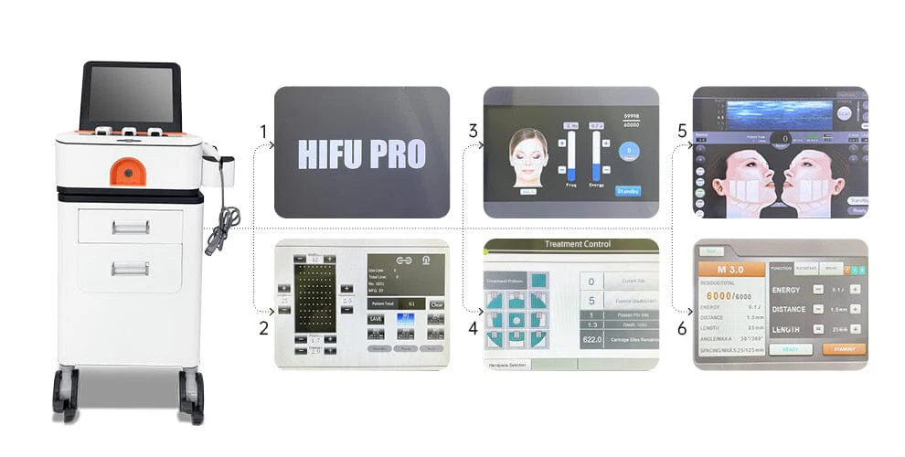 High-intensity focused ultrasound (HIFU) Laser - Image 3